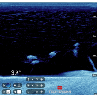 Poseidon Pulse (Black) 3D-downscan